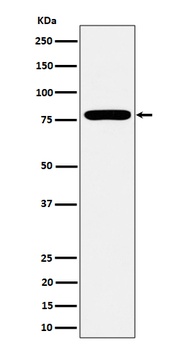 Anti-GFPT1 Rabbit Monoclonal Antibody