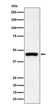 Cytokeratin 19 Rabbit Monoclonal Antibody