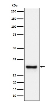 Anti-Adiponectin Rabbit Monoclonal Antibody