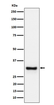 Adiponectin Rabbit Monoclonal Antibody