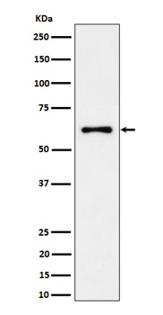 Anti-EYA2 Rabbit Monoclonal Antibody