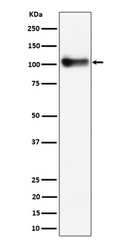 Anti-Thrombomodulin / CD141 Rabbit Monoclonal Antibody