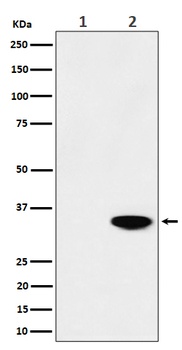 Phospho-Nucleophosmin (T199) Rabbit Monoclonal Antibody
