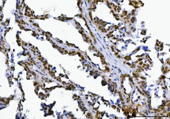 Anti-SPT5/SUPT5H Antibody