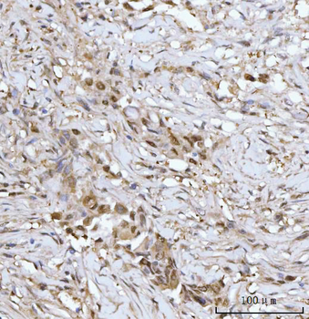 Anti-PRMT5 Antibody