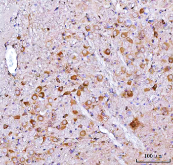 Anti-Nms Antibody