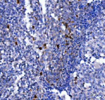 Anti-NCR1 Antibody