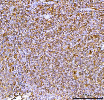 Anti-IL34 Antibody