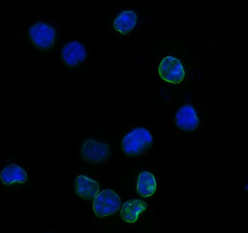 Anti-Il2ra Antibody