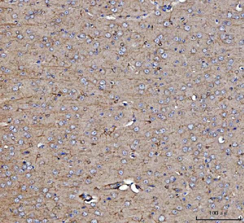Anti-Dkk1 Antibody