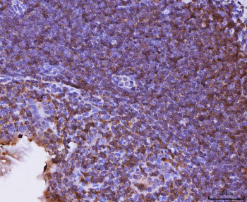 Anti-Cxcr3 Antibody