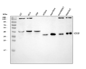 Anti-CD1B Antibody