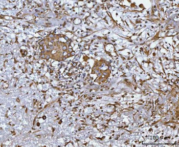 Anti-CCL14 Antibody