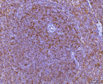Anti-Ccl3 Antibody
