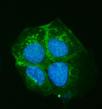 Anti-ATP7B Antibody