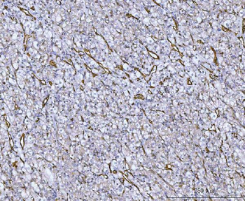 Anti-Von Willebrand Factor/VWF Antibody