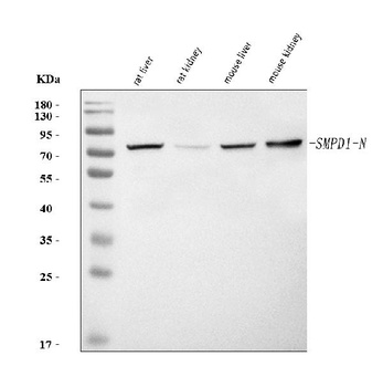 Smpd1 Antibody
