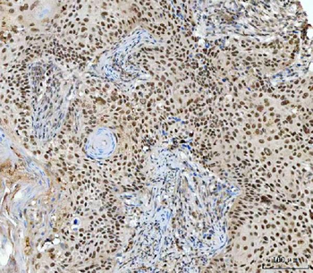 Anti-RING2/RING1B/RNF2 Antibody