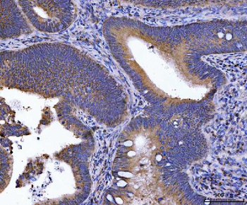 Anti-GOLGA3 Antibody