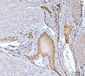 Anti-Clusterin/CLU Antibody
