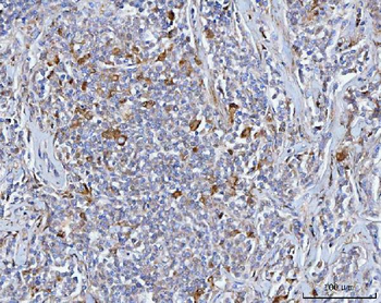 Anti-BCAT1 Antibody