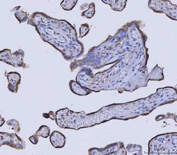 Anti-Glycine decarboxylase/GLDC Antibody (monoclonal, 3D3D3)