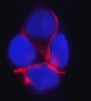 Anti-delta 1 Catenin/CAS/CTNND1 Antibody (monoclonal, 8G7E4)