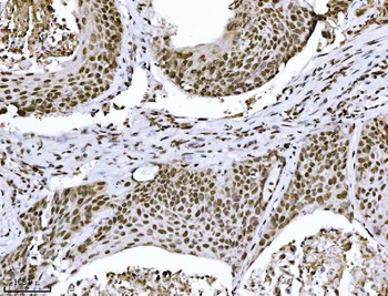 Anti-KPNB1 Antibody (monoclonal, 3I11F2)