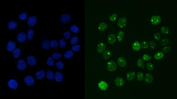 Anti-RCC1 Antibody (monoclonal, 6B11E7)