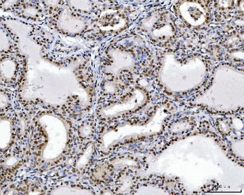 RCC1 Antibody (monoclonal, 6B11E7)