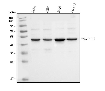 Anti-Cyclin E1/CCNE1 Antibody (monoclonal, 8B9C3)