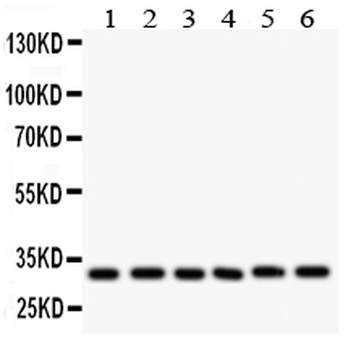 Anti-Caspase 3/CASP3 Antibody