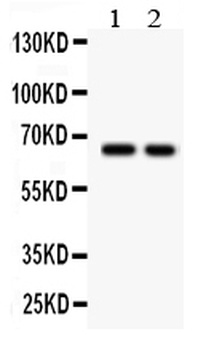 Anti-TGF beta Receptor II/TGFBR2 Antibody