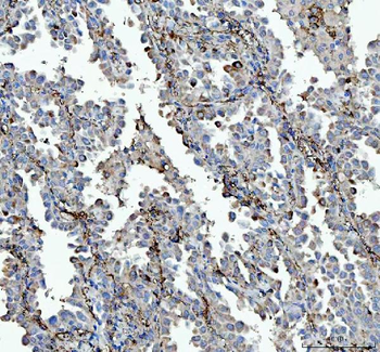 Anti-VPAC2/VIPR2 Antibody