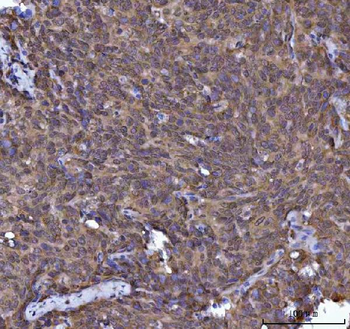Anti-SOCS1 Antibody