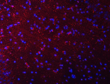 Anti-Septin 2/SEPTIN2 Antibody