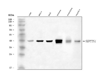 LARP/SEPTIN1 Antibody