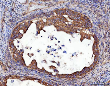 Anti-RRS1 Antibody