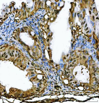Anti-PSMB4 Antibody
