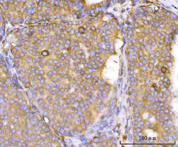 Anti-Eg5/KIF11 Antibody