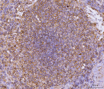 Anti-CD135/FLT3 Antibody
