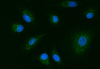 Anti-YWHAE Antibody