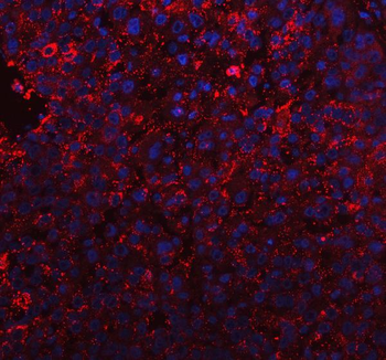 Anti-BI-1/TMBIM6 Antibody