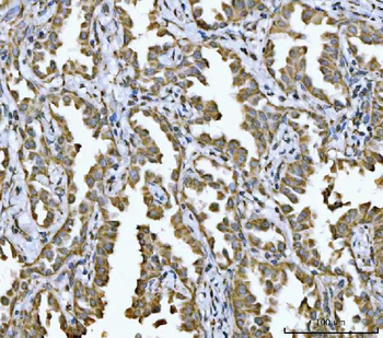 Anti-NDUFV2 Antibody