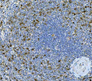 Anti-IL17A Antibody