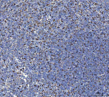 Anti-IL-10/IL10 Antibody