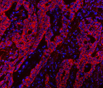 Anti-CLASP1 Antibody