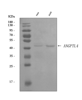 Anti-Angiopoietin-like 4/ANGPTL4 Antibody