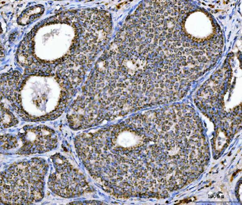 Anti-Aconitase 2 Antibody (monoclonal, 4C12D1)