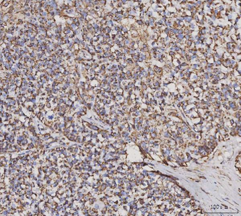 Anti-MDH2 Antibody (monoclonal, 5D8C1)